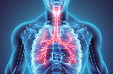 RESPIRATORY DISEASES