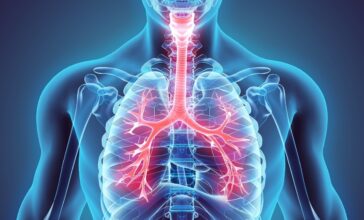 RESPIRATORY DISEASES